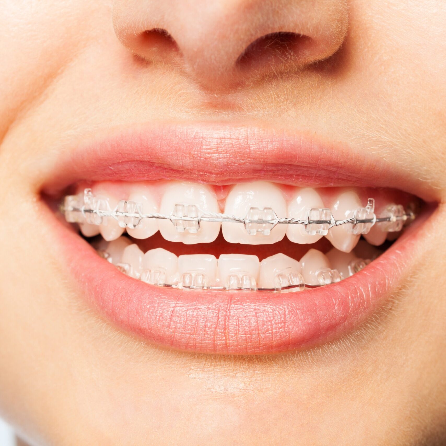 moorestown orthodontist